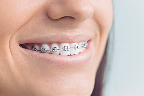 Best Veneers and Lumineers  in South Beloit, IL